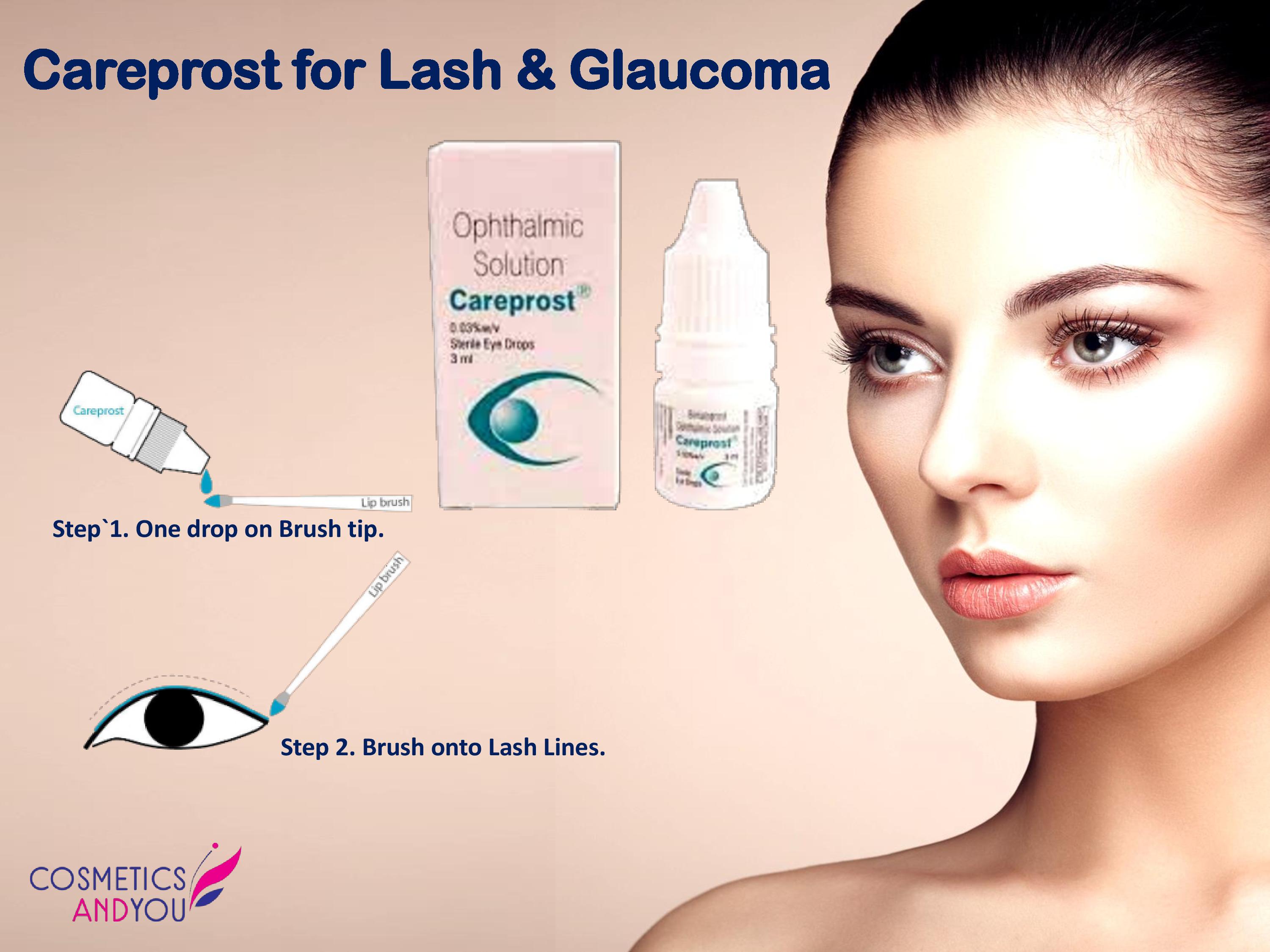 Bimatoprost for Glaucoma and Growth of Eyelashes