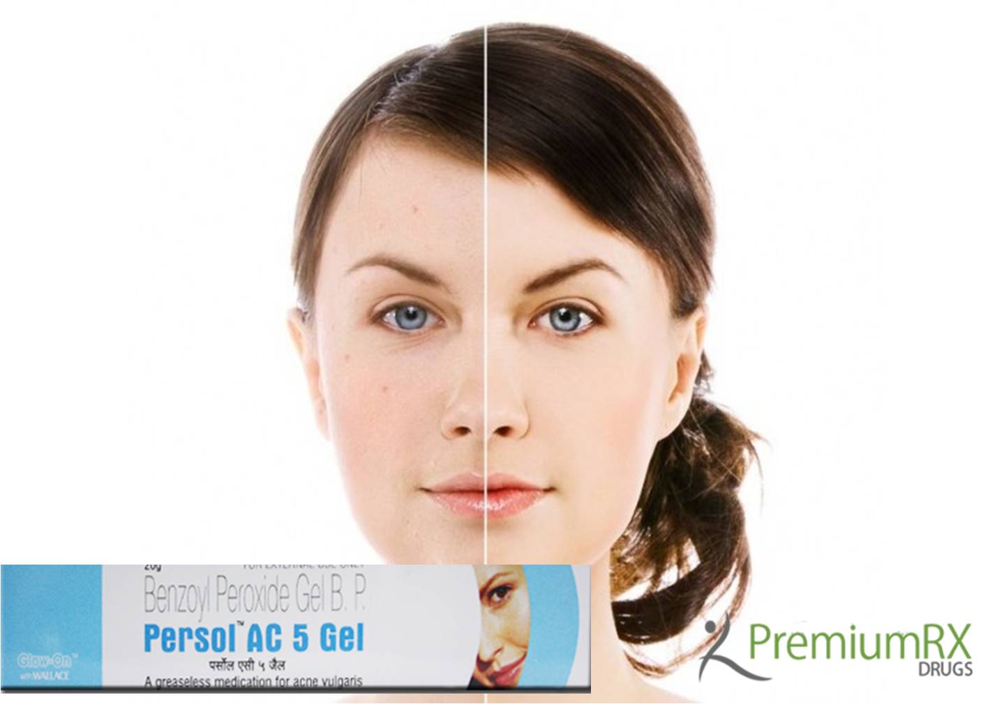 Benzoyl Peroxide Gel Online