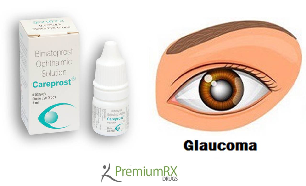 Best Way to Treat Glaucoma