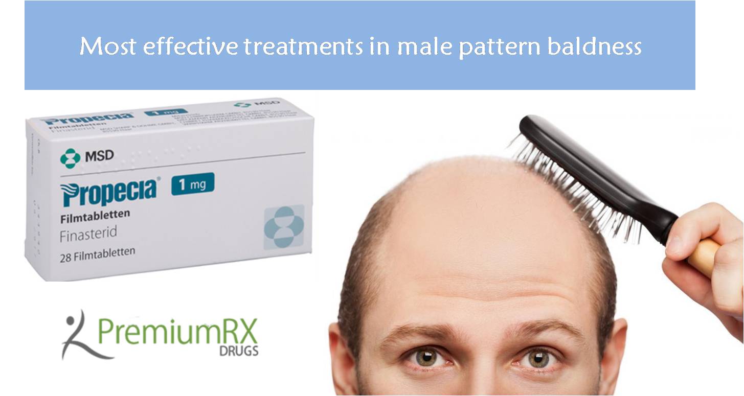 can you get finasteride on prescription