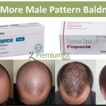 Generic Finasteride vs Propecia