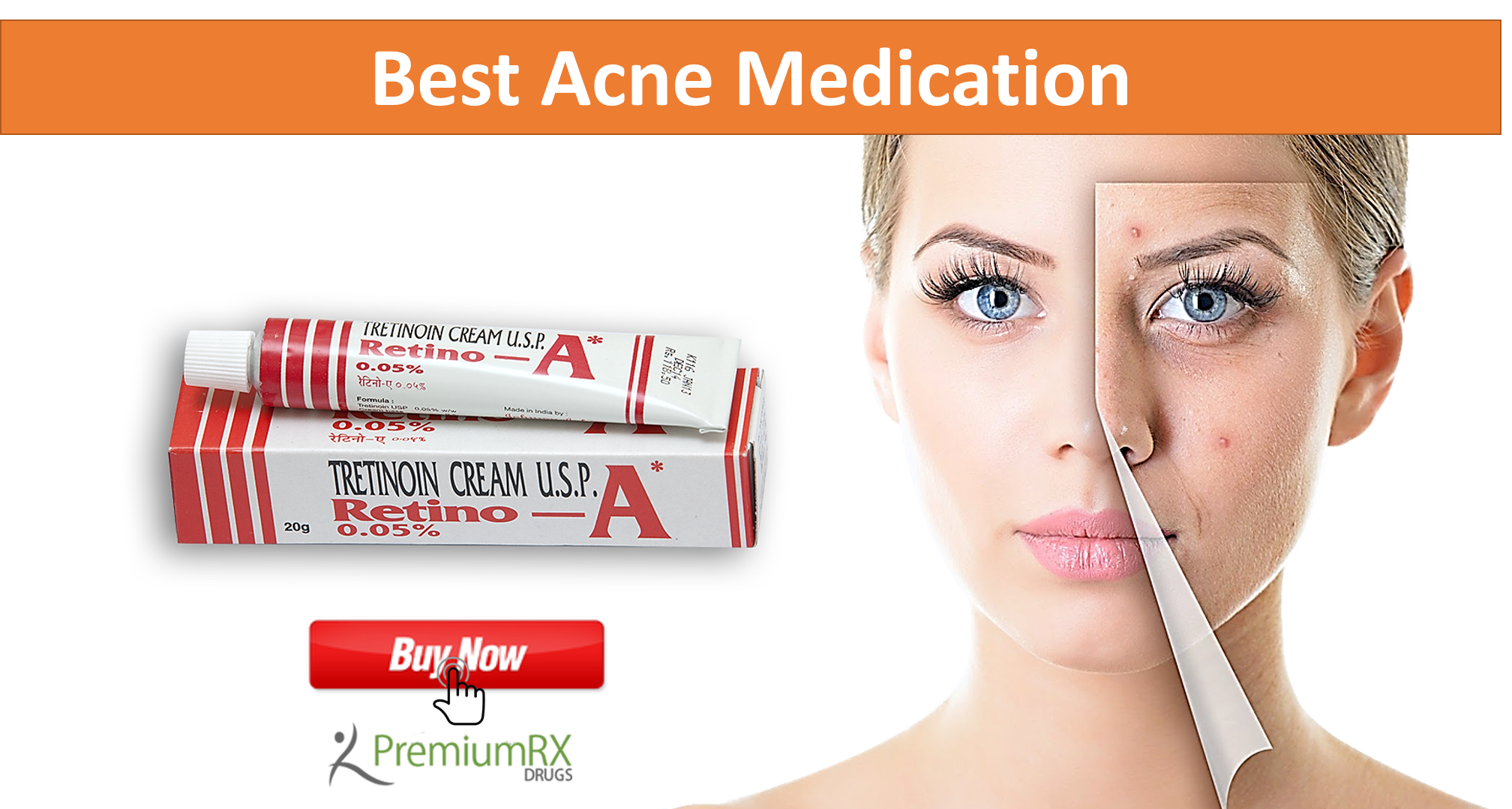 Best Medication for Pimple Treatment