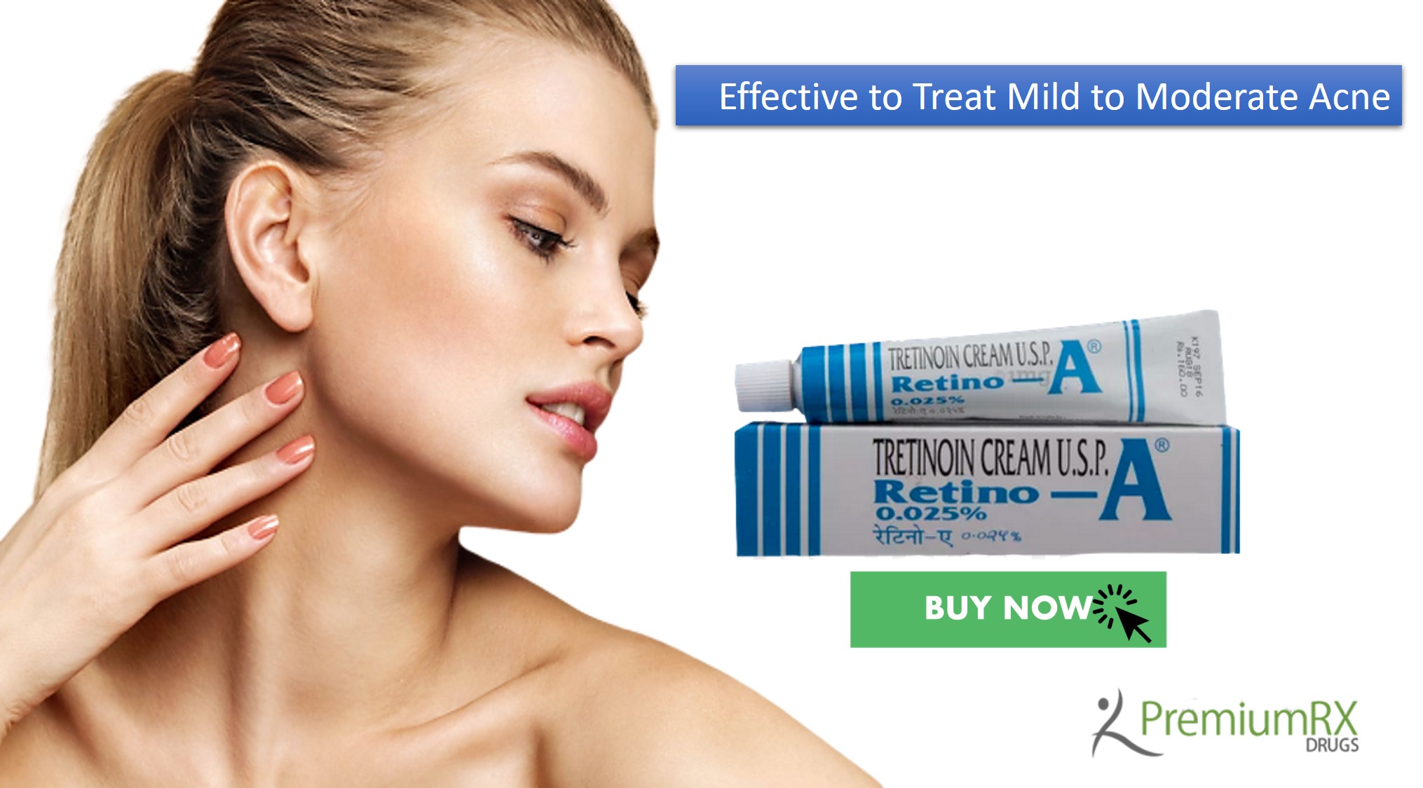 Tretinoin for Acne Treatment