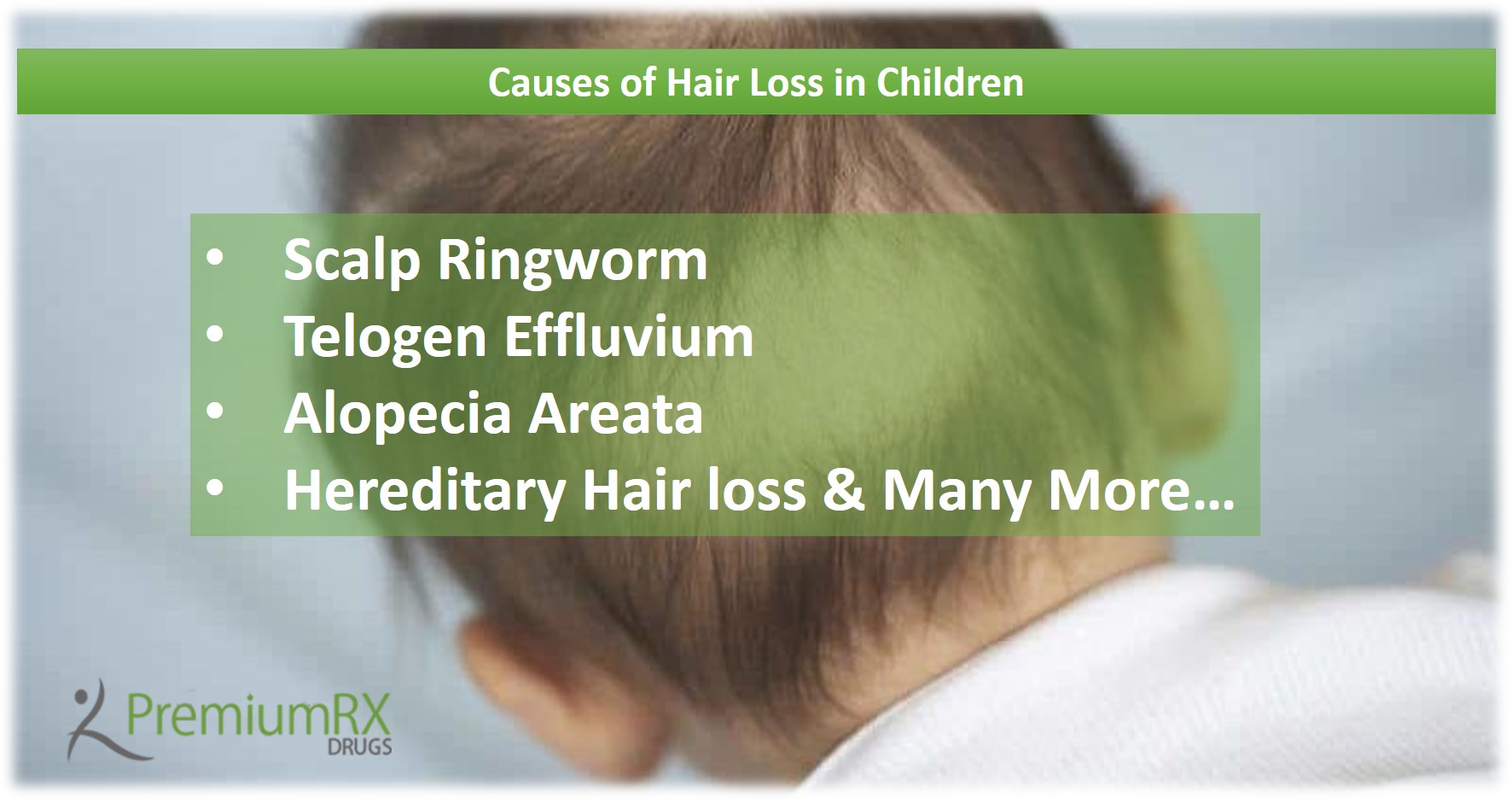 Causes of Hair Loss in Children