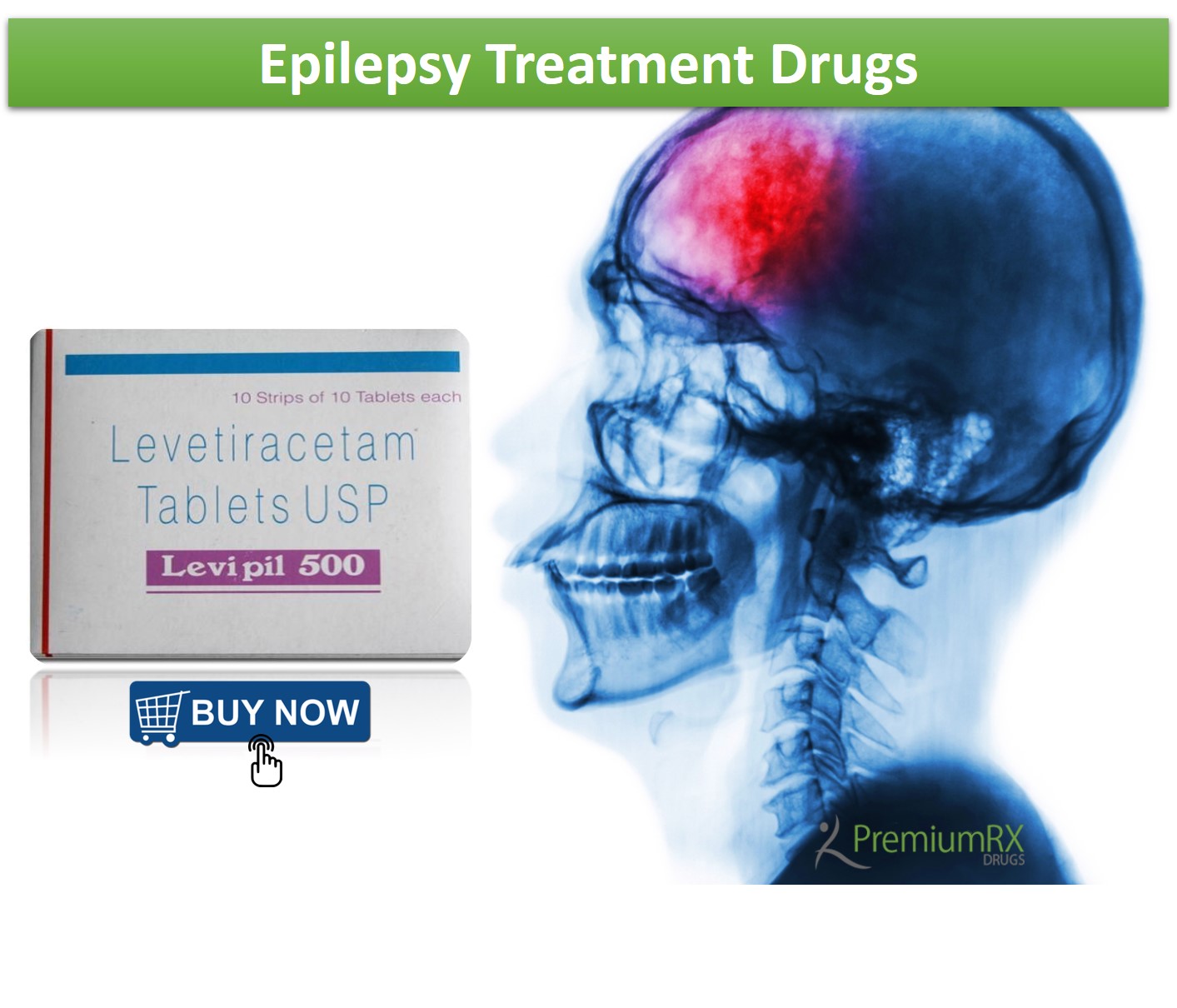 Epilepsy Treatment Drugs