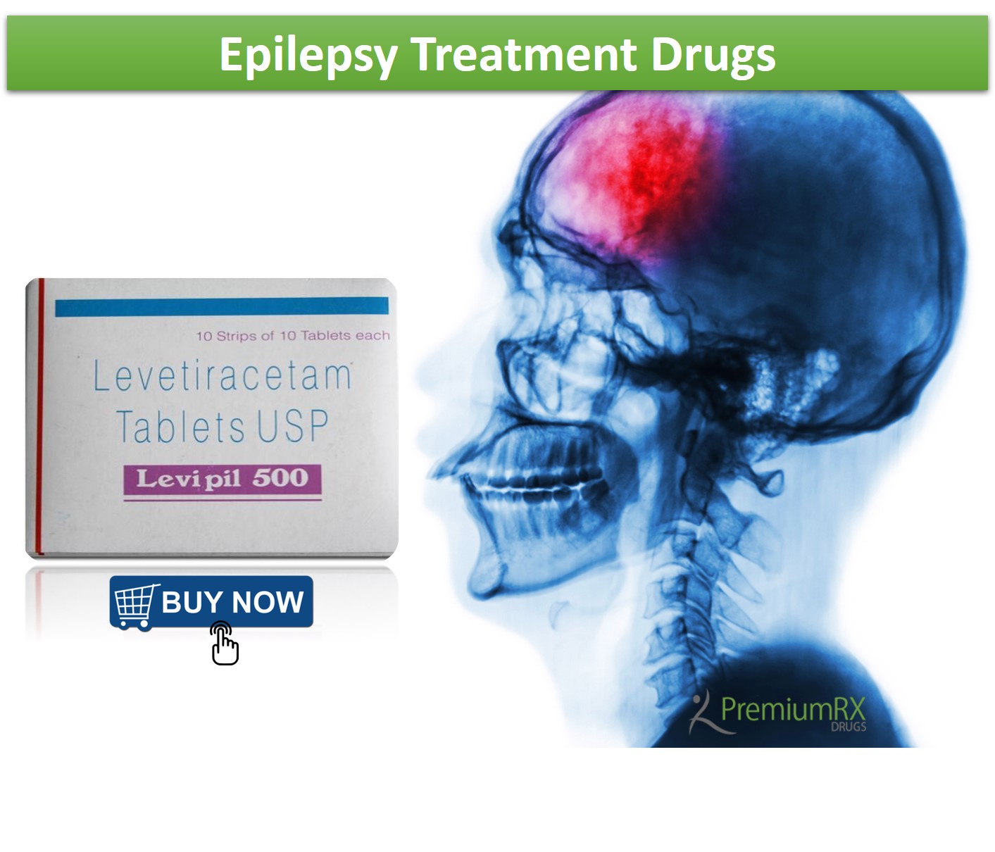 epilepsy-treatment-drugs-premiumrx-online-pharmacy