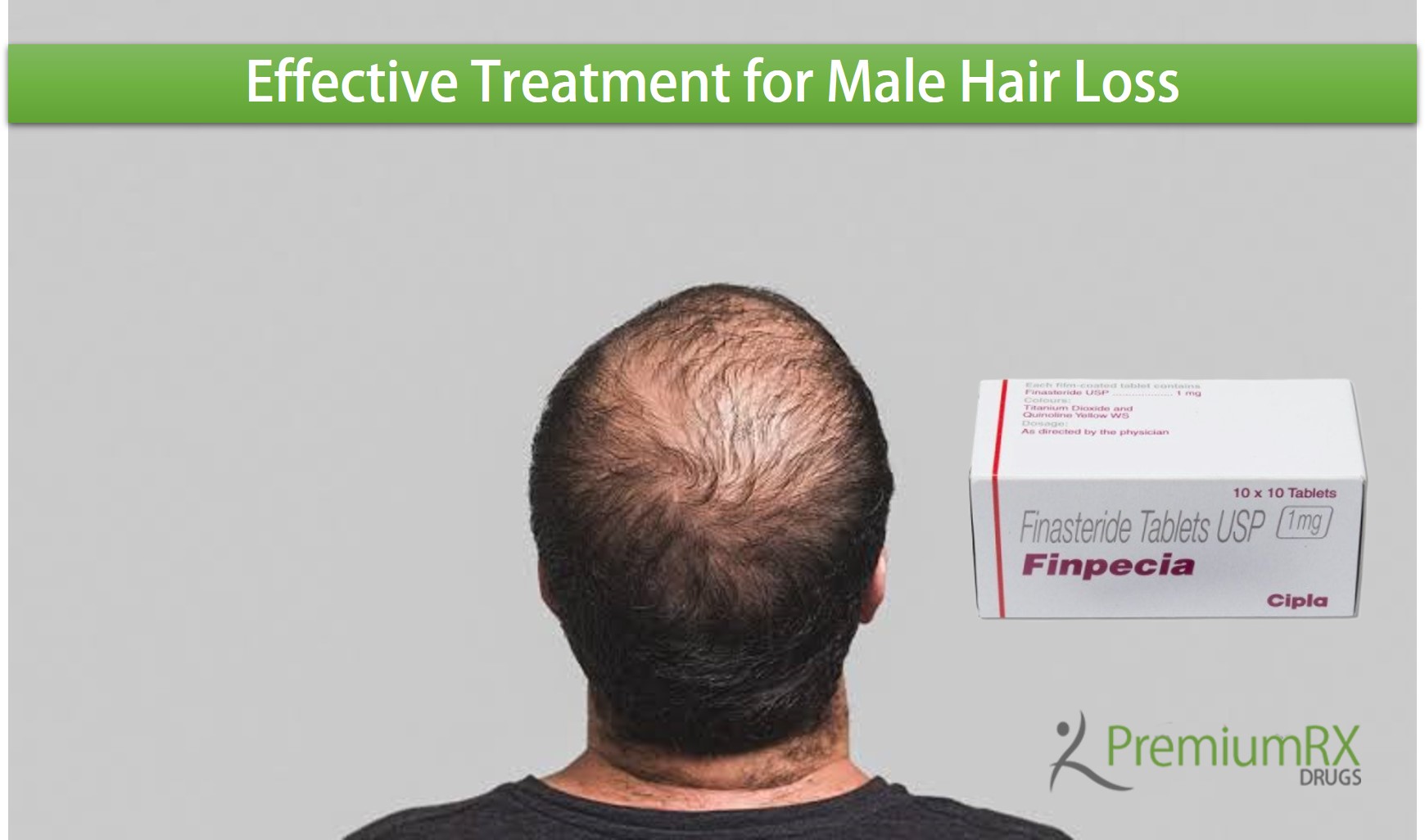 Use of Finpecia 1mg Tablets for Hair Loss