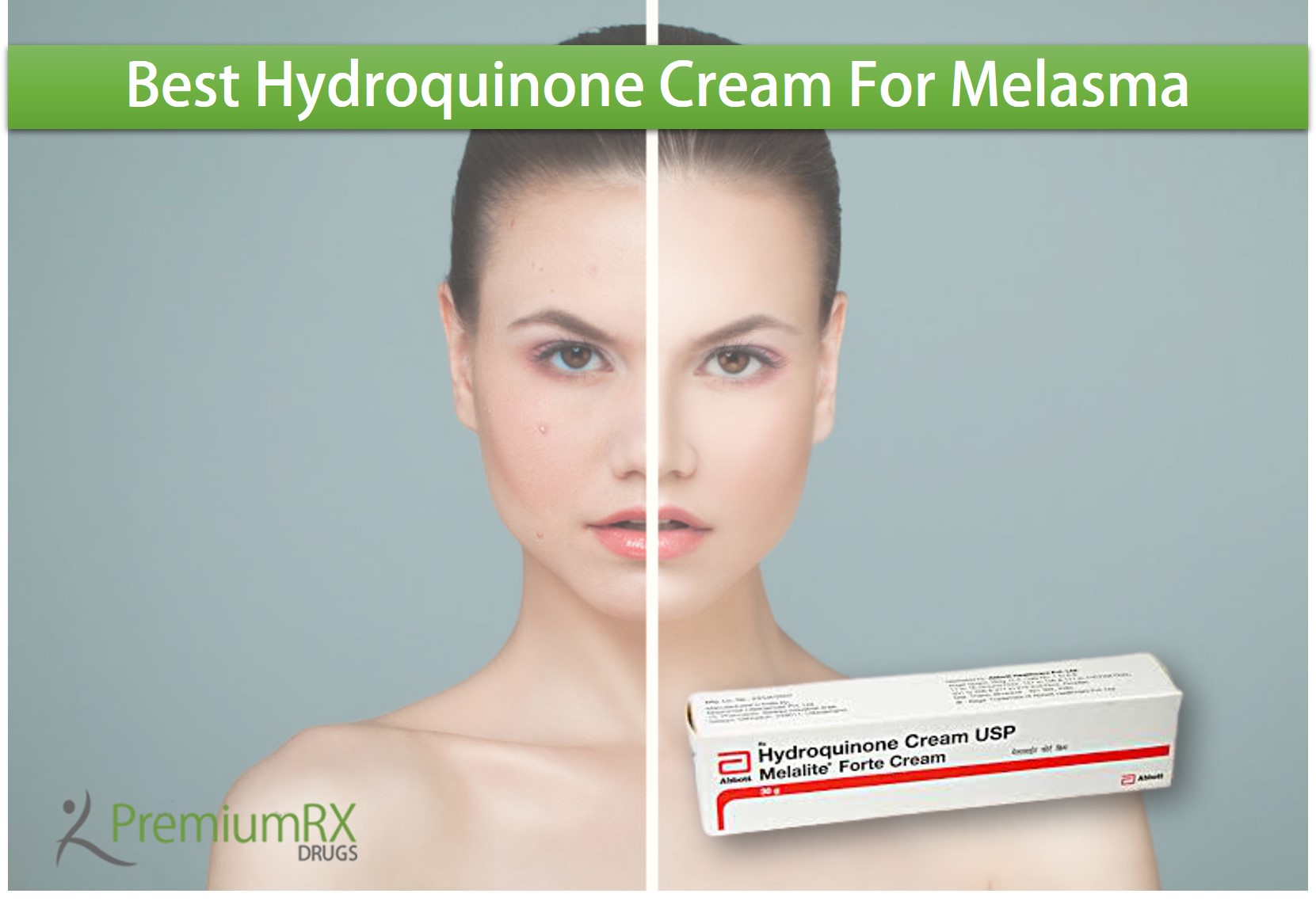 Hydroquinone Cream For Melasma