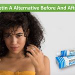 Retin A Alternative Before And After