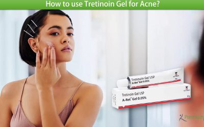 How to use Tretinoin Gel for Acne?