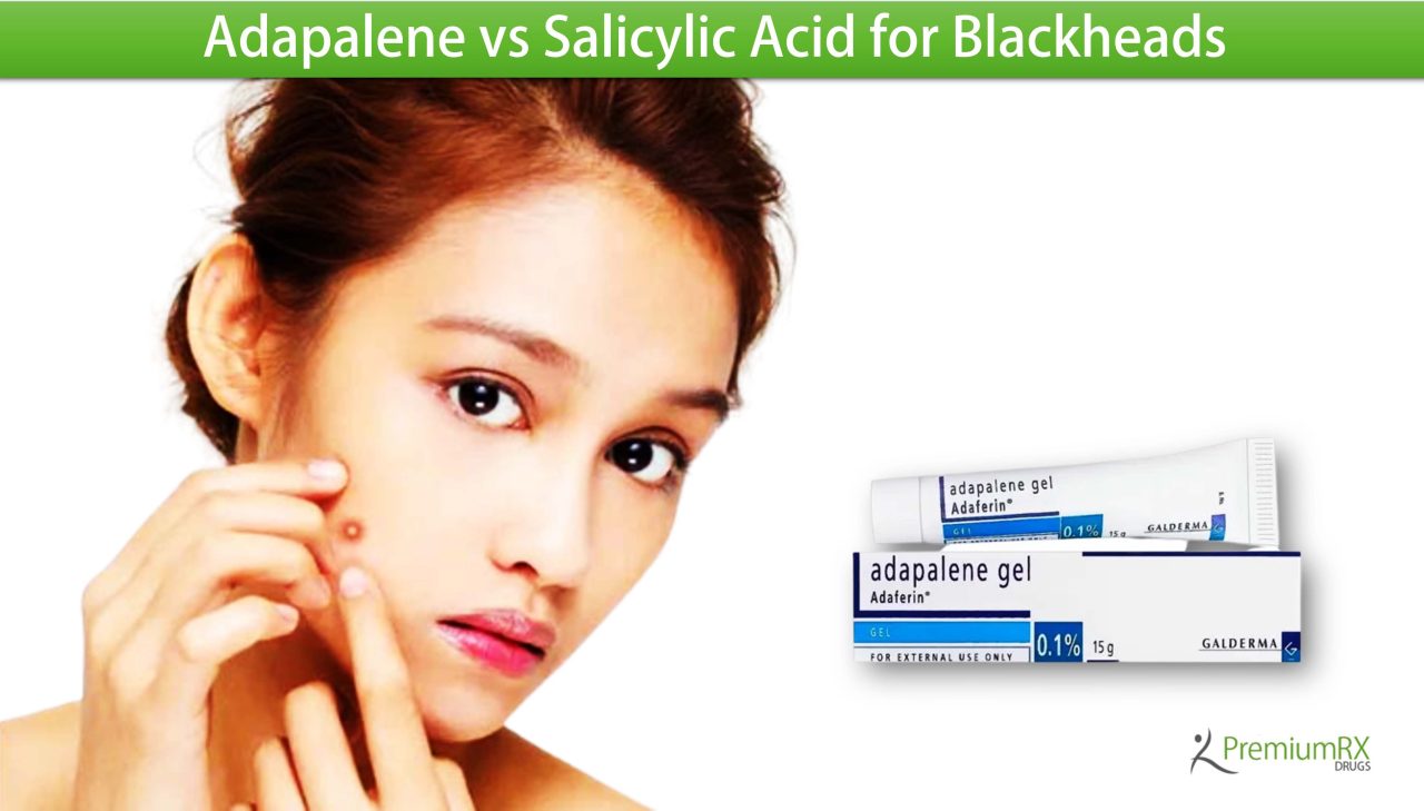 Adapalene vs Salicylic Acid for Blackheads PremiumRx Online Pharmacy