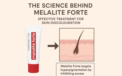 The Science Behind Melalite Forte: Effective Treatment for Skin Discolouration