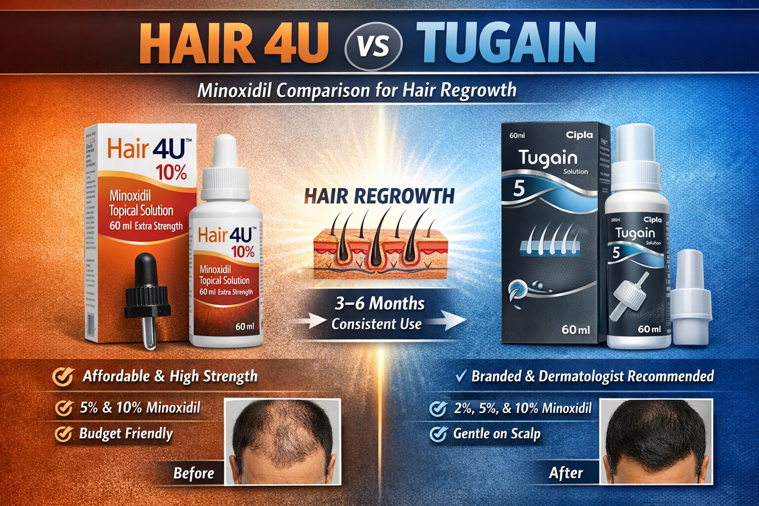 Hair 4U vs Tugain Minoxidil – Comparison, Benefits & Side Effects