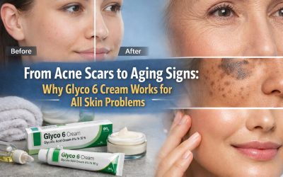 From Acne Scars to Aging Signs: Why Glyco 6 Cream Works for All Skin Problems