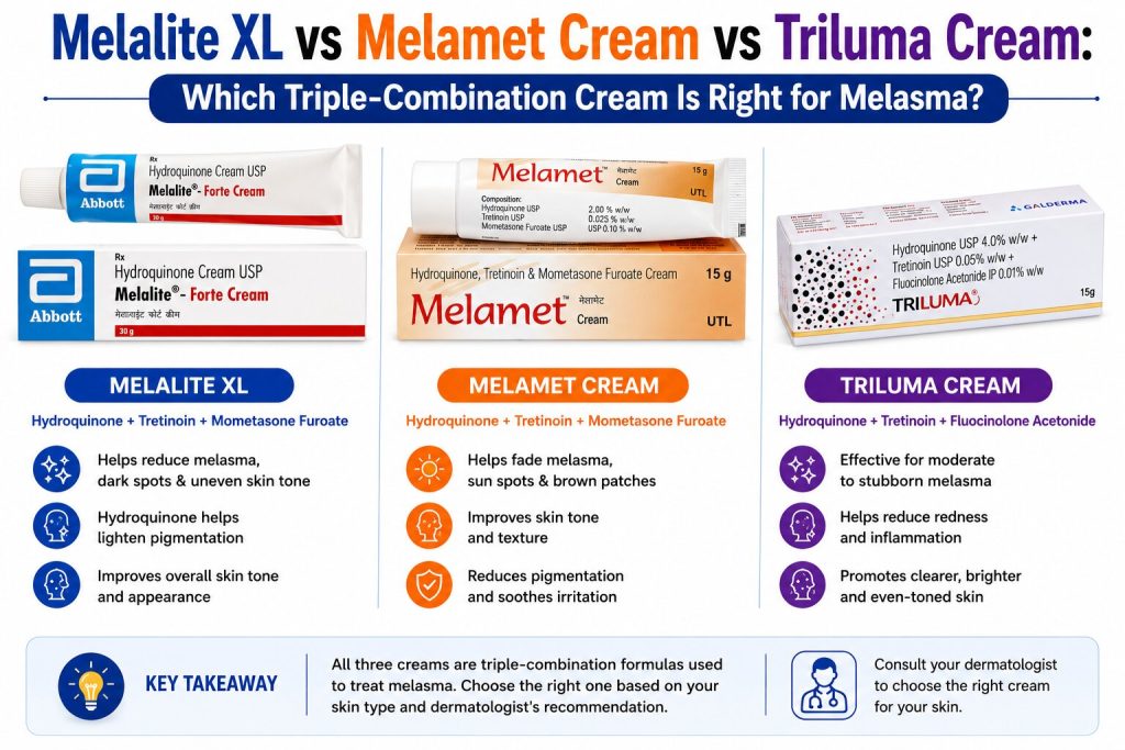 Comparison infographic of Melalite XL, Melamet Cream, and Triluma Cream for melasma treatment, highlighting their active ingredients and key skin-brightening benefits.